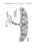 METHOD OF COLLECTING PLACENTAL STEM CELLS diagram and image