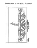 METHOD OF COLLECTING PLACENTAL STEM CELLS diagram and image