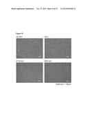 ENDOTHELIAL CELL PRODUCTION BY PROGRAMMING diagram and image