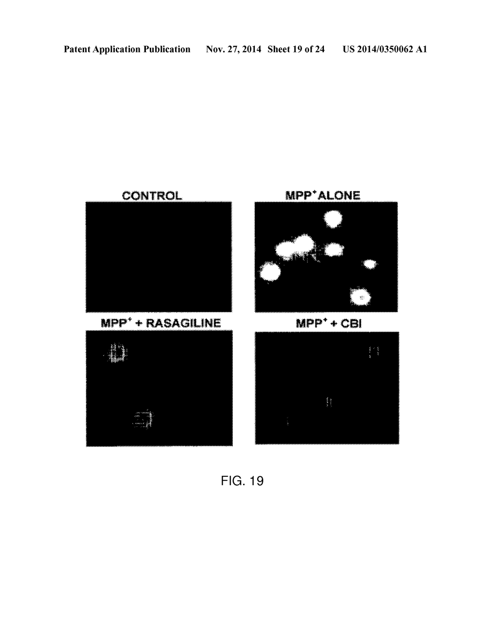 PHARMACEUTICAL COMPOSITION FOR INHIBITING APOPTOSIS OF NEURON OR     NEURODEGENERATION - diagram, schematic, and image 20