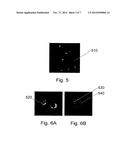 COMPOSITIONS AND THEIR USES FOR GENE THERAPY OF BONE CONDITIONS diagram and image