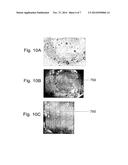 COMPOSITIONS AND THEIR USES FOR GENE THERAPY OF BONE CONDITIONS diagram and image