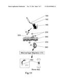 COMPOSITIONS AND THEIR USES FOR GENE THERAPY OF BONE CONDITIONS diagram and image