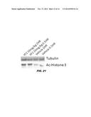 USES OF HISTONE ACETYLTRANSFERASE ACTIVATORS diagram and image