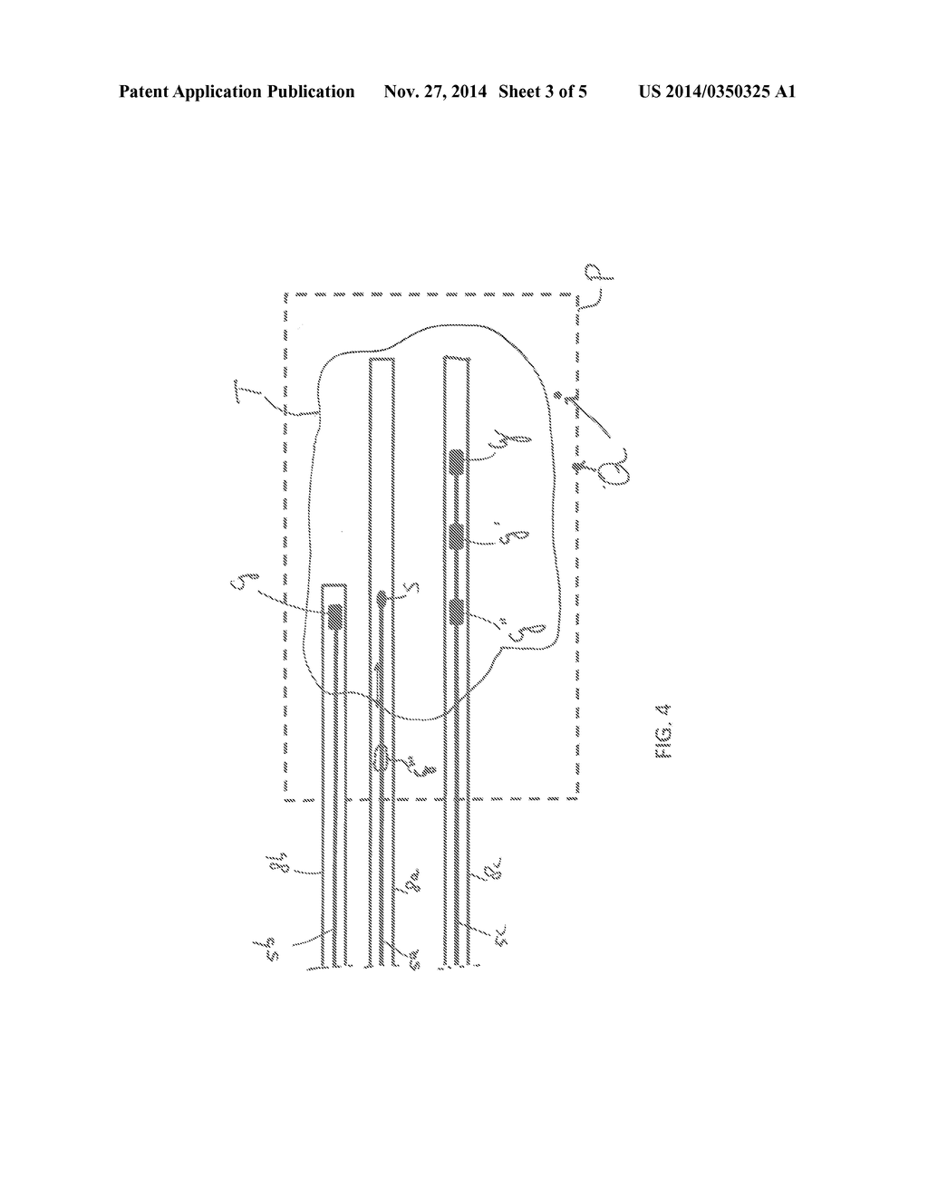 AFTERLOADING DEVICE, AND USE THEREOF - diagram, schematic, and image 04