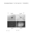 System for Imaging Lesions Aligning Tissue Surfaces diagram and image