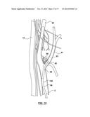 CAROTID BODY ABLATION VIA DIRECTED ENERGY diagram and image