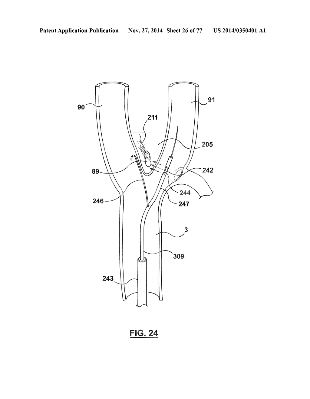 CAROTID BODY ABLATION VIA DIRECTED ENERGY - diagram, schematic, and image 27