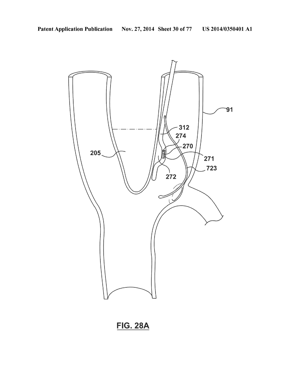 CAROTID BODY ABLATION VIA DIRECTED ENERGY - diagram, schematic, and image 31