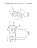 CAROTID BODY ABLATION VIA DIRECTED ENERGY diagram and image