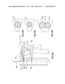 CAROTID BODY ABLATION VIA DIRECTED ENERGY diagram and image