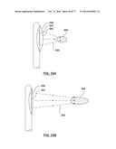 CAROTID BODY ABLATION VIA DIRECTED ENERGY diagram and image