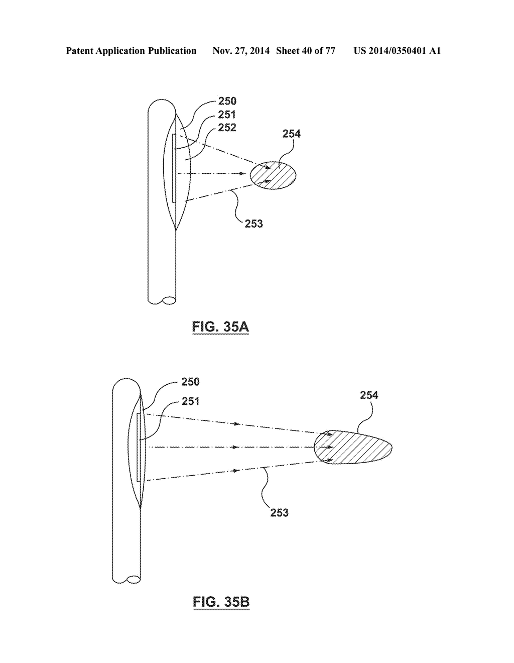 CAROTID BODY ABLATION VIA DIRECTED ENERGY - diagram, schematic, and image 41