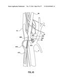 CAROTID BODY ABLATION VIA DIRECTED ENERGY diagram and image