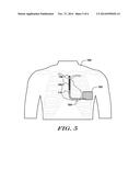 IMPLANTABLE CARDIAC SYSTEMS WITH BASELINE CORRECTION IN RESPONSE TO NOISE     DETECTION diagram and image