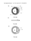 Infusion Pump Assembly diagram and image