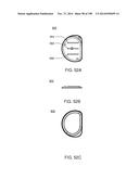 Infusion Pump Assembly diagram and image