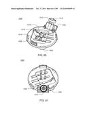 Infusion Pump Assembly diagram and image