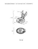 Infusion Pump Assembly diagram and image