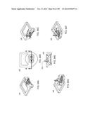 Infusion Pump Assembly diagram and image