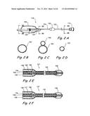 Devices and Methods for Delivering Therapeutic Substances for the     Treatment of Sinusitis and Other Disorders diagram and image