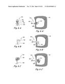 Devices and Methods for Delivering Therapeutic Substances for the     Treatment of Sinusitis and Other Disorders diagram and image