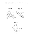 INTRAVESICAL DRUG DELIVERY DEVICE diagram and image