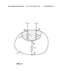 IMPEDANCE COMPUTATION FOR ABLATION THERAPY diagram and image