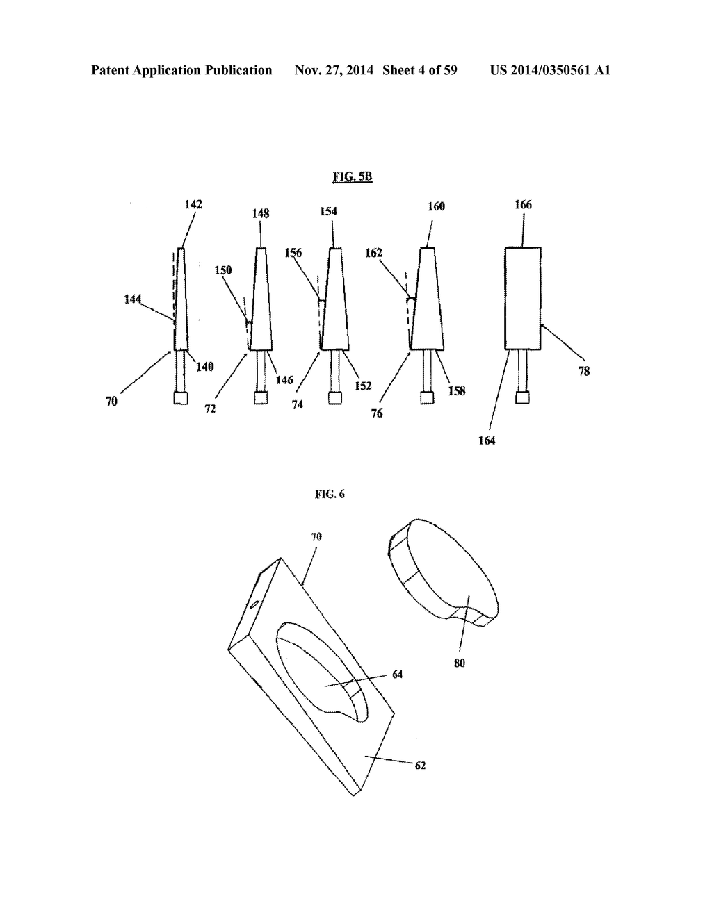 BONE IMPLANTS AND CUTTING APPARATUSES AND METHODS - diagram, schematic, and image 05