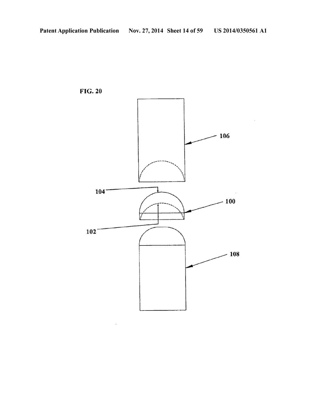 BONE IMPLANTS AND CUTTING APPARATUSES AND METHODS - diagram, schematic, and image 15