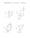 STENT AND OTHER OBJECT REMOVAL FROM A BODY diagram and image