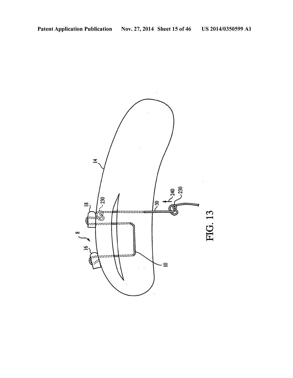 CLOSURE DEVICE AND METHOD FOR TISSUE REPAIR - diagram, schematic, and image 16