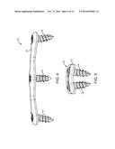 ANTERIOR CERVICAL PLATE diagram and image