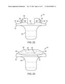 ANTERIOR CERVICAL PLATE diagram and image