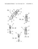 METHODS AND SYSTEMS FOR MATERIAL FIXATION diagram and image