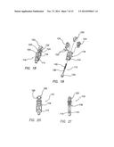 METHODS AND SYSTEMS FOR MATERIAL FIXATION diagram and image