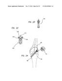 METHODS AND SYSTEMS FOR MATERIAL FIXATION diagram and image