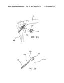 METHODS AND SYSTEMS FOR MATERIAL FIXATION diagram and image