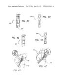 METHODS AND SYSTEMS FOR MATERIAL FIXATION diagram and image