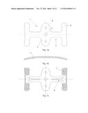 Device For Use In Surgical Treatment Of Funnel Chest And Method Of     Treatment diagram and image