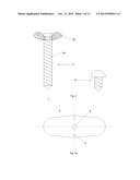 Device For Use In Surgical Treatment Of Funnel Chest And Method Of     Treatment diagram and image