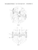 Device For Use In Surgical Treatment Of Funnel Chest And Method Of     Treatment diagram and image