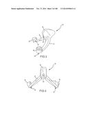 PATIENT-MATCHED APPARATUS AND METHODS FOR PERFORMING SURGICAL PROCEDURES diagram and image