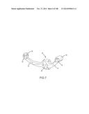 PATIENT-MATCHED APPARATUS AND METHODS FOR PERFORMING SURGICAL PROCEDURES diagram and image