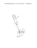 PATIENT-MATCHED APPARATUS AND METHODS FOR PERFORMING SURGICAL PROCEDURES diagram and image