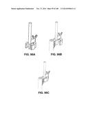 PATIENT-MATCHED APPARATUS AND METHODS FOR PERFORMING SURGICAL PROCEDURES diagram and image