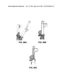 PATIENT-MATCHED APPARATUS AND METHODS FOR PERFORMING SURGICAL PROCEDURES diagram and image