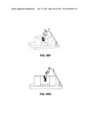 PATIENT-MATCHED APPARATUS AND METHODS FOR PERFORMING SURGICAL PROCEDURES diagram and image