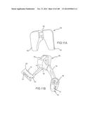 PATIENT-MATCHED APPARATUS AND METHODS FOR PERFORMING SURGICAL PROCEDURES diagram and image