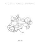 PATIENT-MATCHED APPARATUS AND METHODS FOR PERFORMING SURGICAL PROCEDURES diagram and image